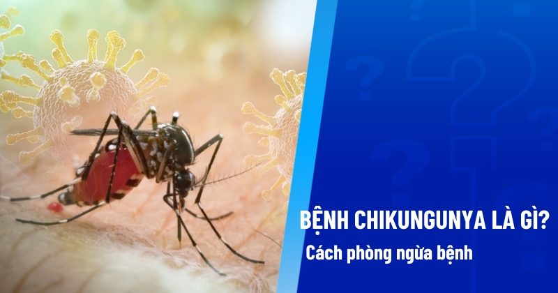BỆNH CHIKUNGUNYA VÀ CÁCH PHÒNG CHỐNG